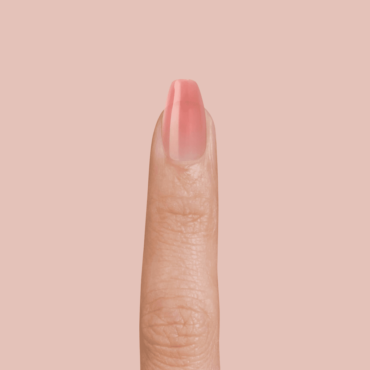 What Do Lupus Fingernails Look Like? 5 Ways To Manage Symptoms | MyLupusTeam